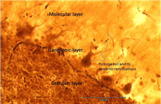 cerebellum2.png