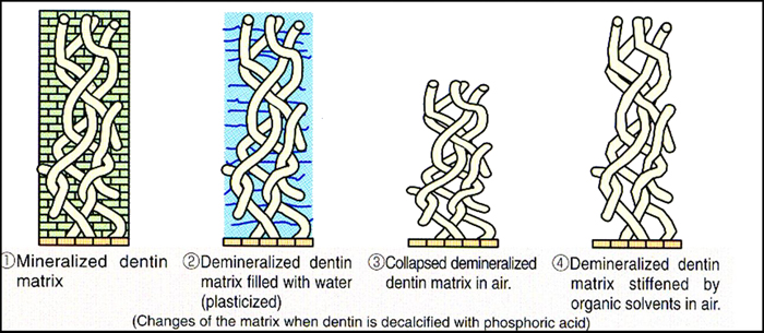 dentin_tubul.jpg