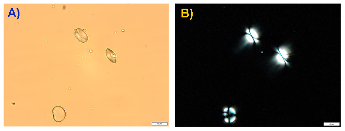 Fig2_Rye_starch_microscopy